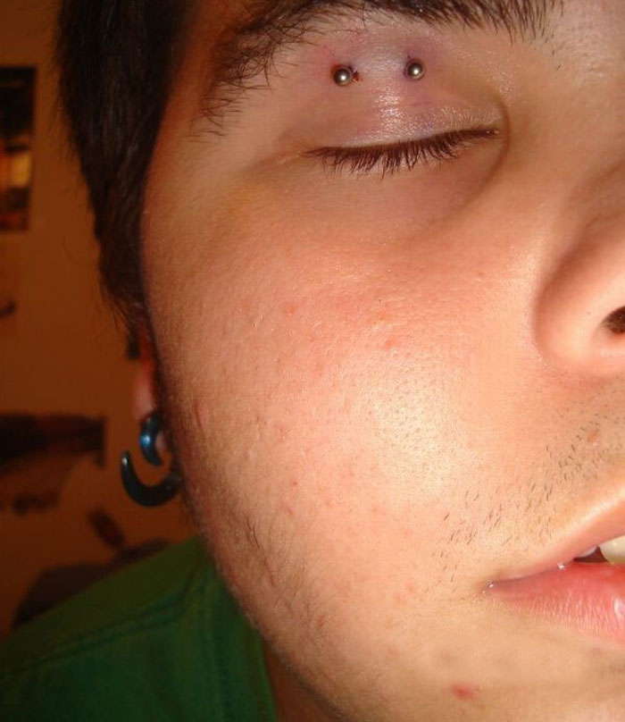 eye piercing
