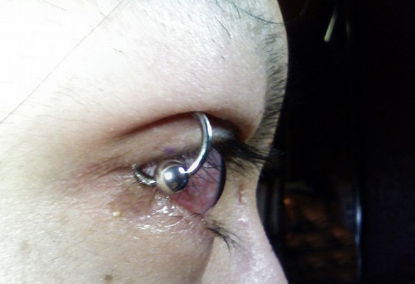 eye piercing